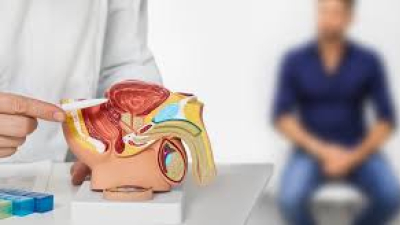 Cada 45 minutos una persona es diagnosticada con cáncer de próstata