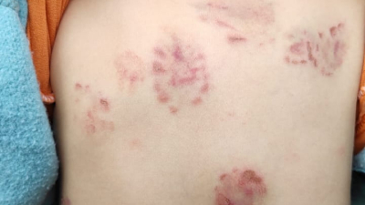 La denuncia de la familia de un niño que sufrió agresiones en un jardín derivó en la intervención del Ministerio