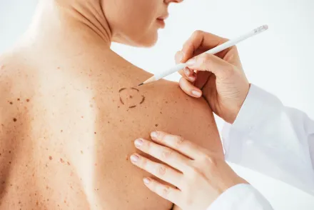 Argentina-sera-el-primer-pais-en-usar-una-vacuna-contra-el-cancer-de-piel-mas-agresivo-1.webp