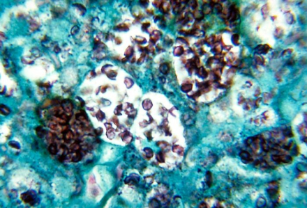 Histoplasmosis_capsulatum.jpg