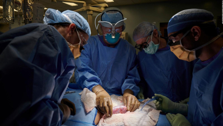 human-pig-kidney.jpg