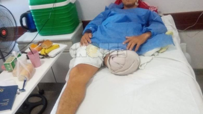 Tuvieron que amputarle la pierna al hombre baleado por un penitenciario en Fontana