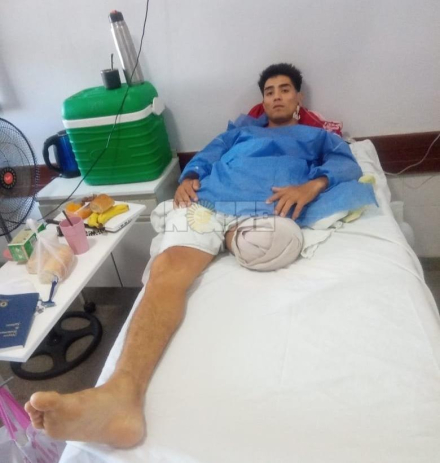 baleado dos.jfif copy
