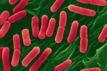 e.coli.jpg