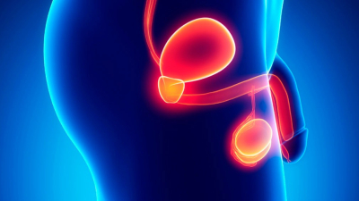Descubren el mecanismo celular que convierte el cáncer de próstata en una amenaza letal