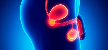 cáncer de próstata00.jpg