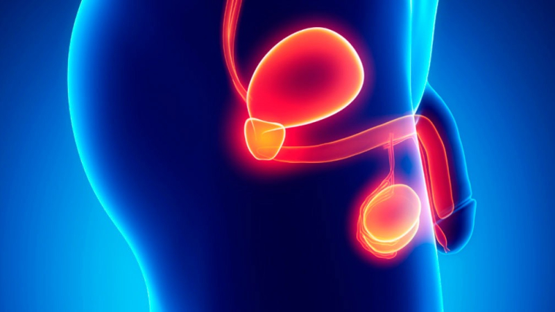 Descubren el mecanismo celular que convierte el cáncer de próstata en una amenaza letal