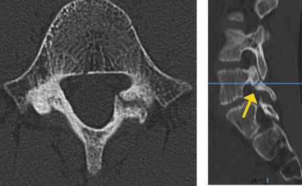 radiogr pediatrica2.jpg