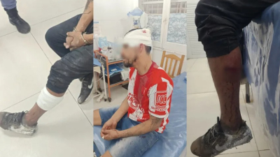 Ataque a balazos en Resistencia: dos heridos, uno con pedido de captura