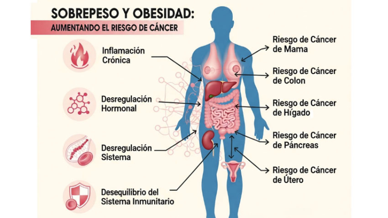 ¿Influyen el sobrepeso y la obesidad en el inicio y progresión del cáncer?