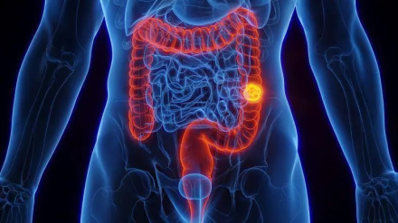 colon.jpg