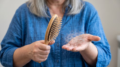Caída del pelo por estrés, primeros signos y métodos para estimular su crecimiento