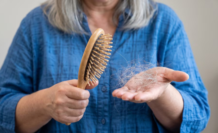Caída del pelo por estrés, primeros signos y métodos para estimular su crecimiento