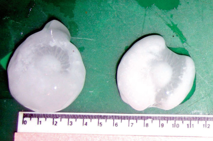 granizo tamaño.jpg