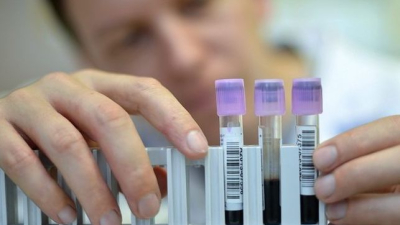 Ocho organizaciones se unieron para combatir la Hepatitis C en Argentina
