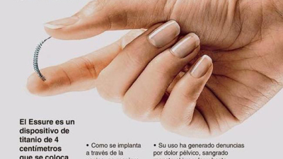 Bayer suspende comercialización del anticonceptivo Essure