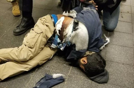 herido3.jpg