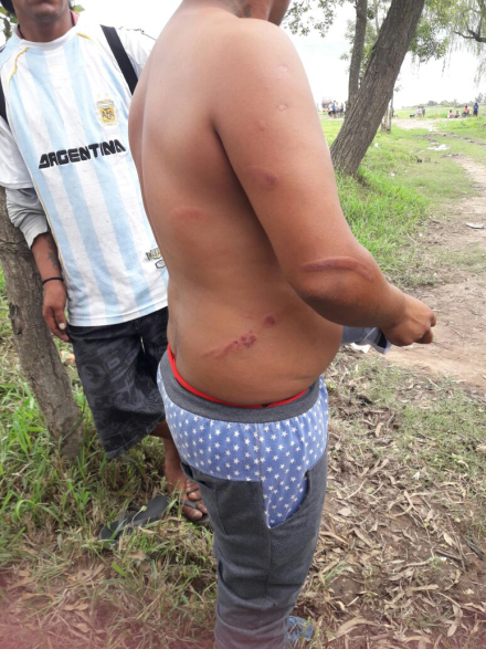 manifestante herido.jpg