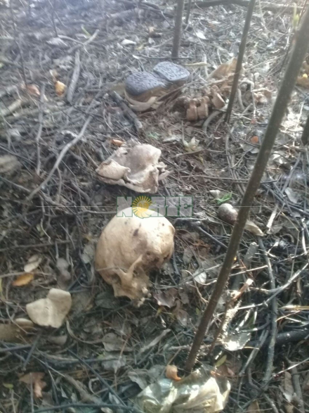 huesos humanos.jpg