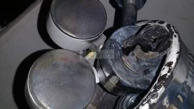 Le explotó un tubo de oxígeno y podría perder el ojo