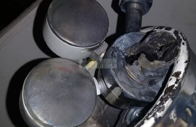 Le explotó un tubo de oxígeno y podría perder el ojo