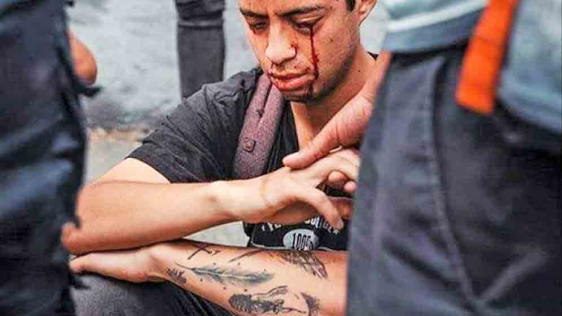 Chile: familia de joven ciego por disparos policiales pide justicia