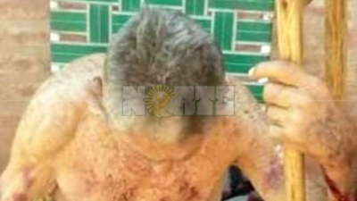 Charata: Un abuelo de 85 años resultó herido al defenderse de un robo