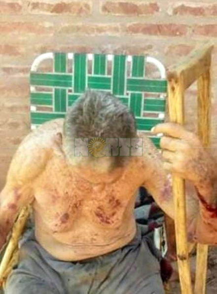 58abuelo herido.jpeg