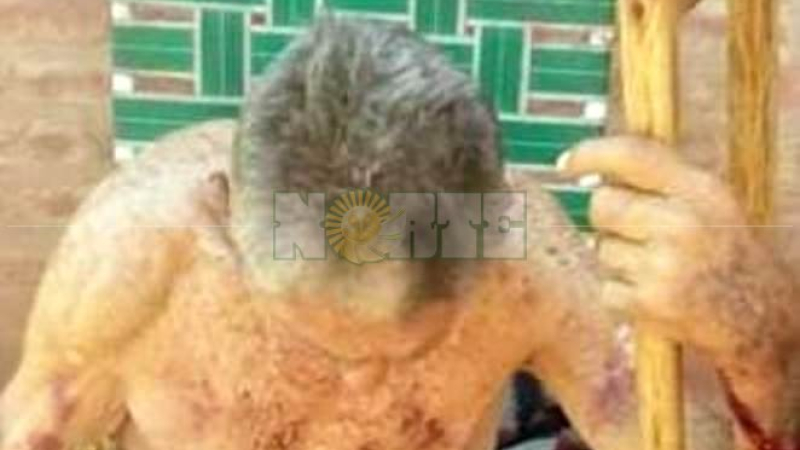 Charata: Un abuelo de 85 años resultó herido al defenderse de un robo