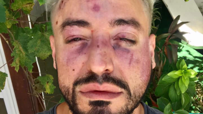 Brutal ataque homofóbico en pleno centro de Resistencia