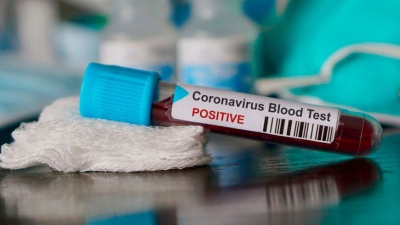 Se confirmaron cuatro muertes más en las últimas 24 horas por Covid en el Chaco