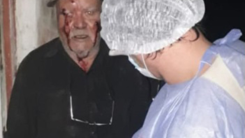 Salvaje ataque a un anciano en un robo perpetrado por menores de edad