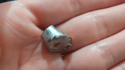 Festejaba Navidad y una bala perdida le impactó en la pierna