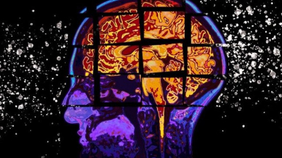 Alzheimer: cómo es la prometedora droga que abre una nueva esperanza para el tratamiento ?