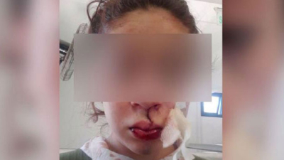 Violencia policial: golpearon a una chica hasta sacarle los dientes
