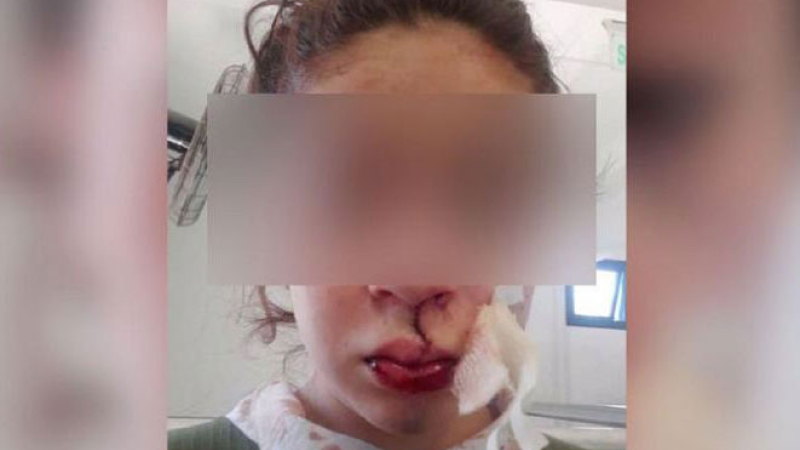 Violencia policial: golpearon a una chica hasta sacarle los dientes