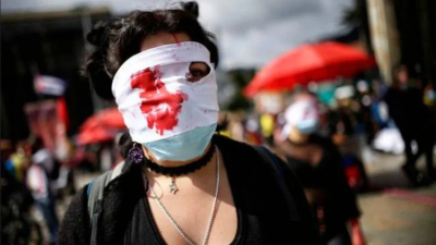 Más de 100 colombianos sufrieron daños oculares a manos de la policía en marchas de 2021