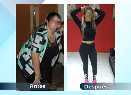 1antesydespues02.jpg
