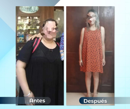 1antesydespues20.jpg