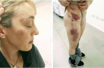 Chaqueña atacada por su marido: desplazan al abogado del STJ y será indagado el 27 de septiembre