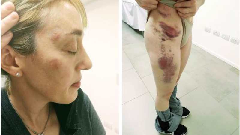 Chaqueña atacada por su marido: desplazan al abogado del STJ y será indagado el 27 de septiembre