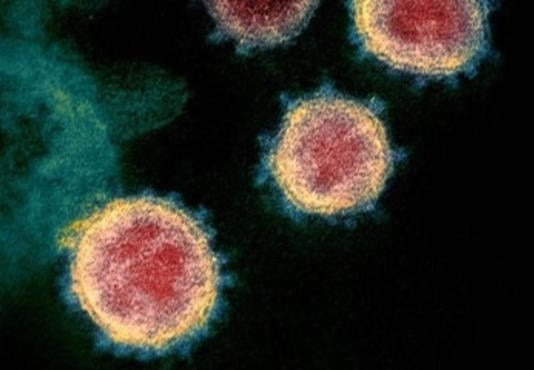 metapneumovirus.jpg