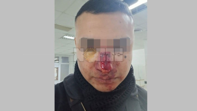 Batalla campal en Sáenz Peña termina con un policía desmayado de un piedrazo