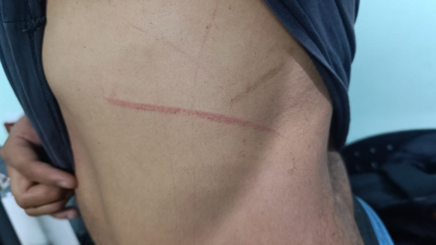 Violento ataque a policías durante operativo: balazos, efectivo herido y sustracción de celular