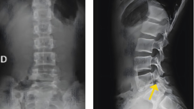 Por qué una radiografía completa puede ser un error peligroso