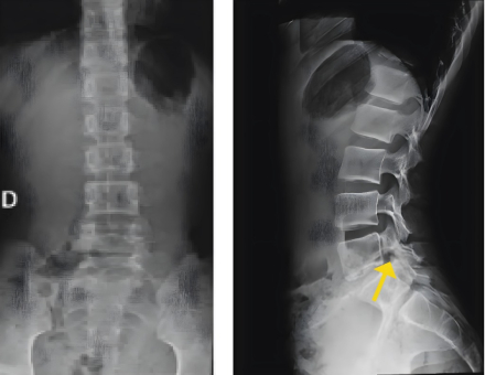 radiogr pediatrica.jpg