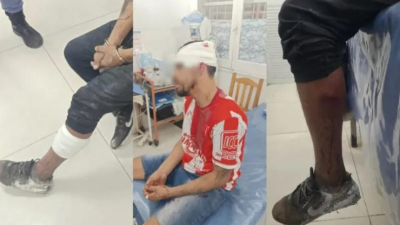 Ataque a balazos en Resistencia: dos heridos, uno con pedido de captura
