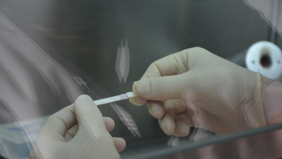 Crearon un innovador test para diagnosticar micosis endémica