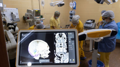 Realizaron una operación del cerebro con asistencia de la neuronavegación