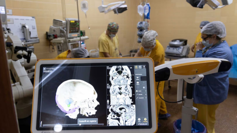 Realizaron una operación del cerebro con asistencia de la neuronavegación